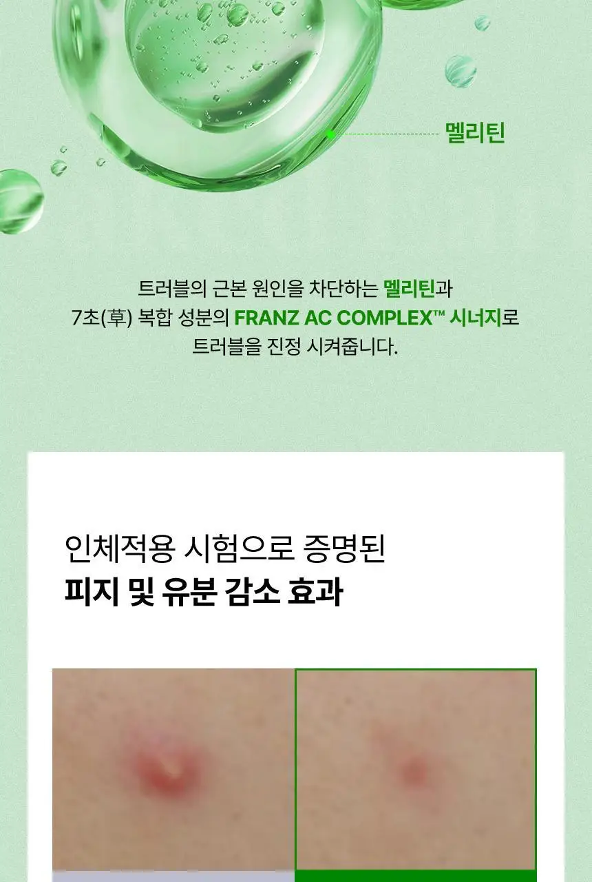 [승헌쓰 PICK] 프란츠 네이키드 스팟 패치 72매입 (얼리, 액티브, 다크) 3종 1 상세페이지 24